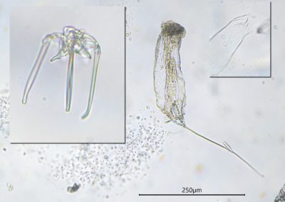 Étude du rotifère Trichocerca cylindrica